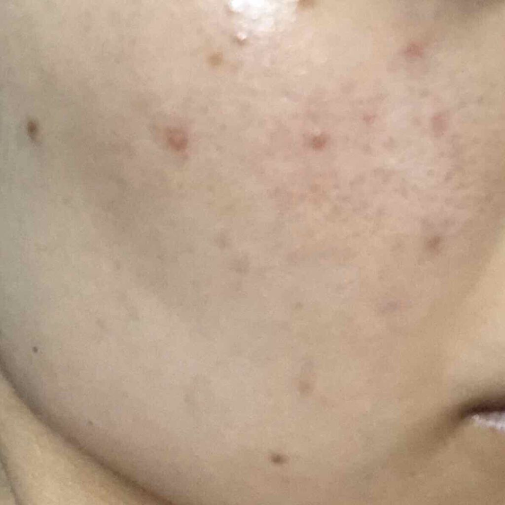 潤浸保湿 化粧水 III とてもしっとり/キュレル/化粧水を使ったクチコミ（2枚目）