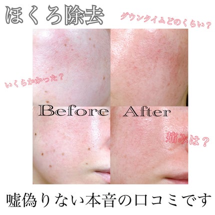 を使ったクチコミ(1枚目)