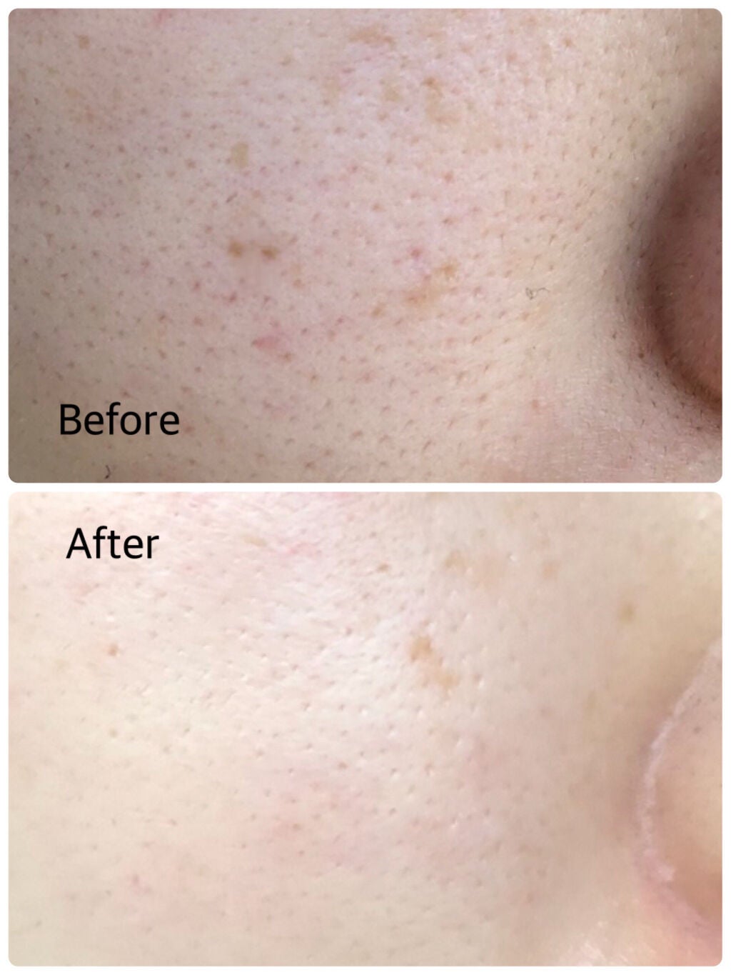 ティーツリーケアソリューション アンプルマスクJEX/MEDIHEAL/シートマスク・パックを使ったクチコミ(2枚目)