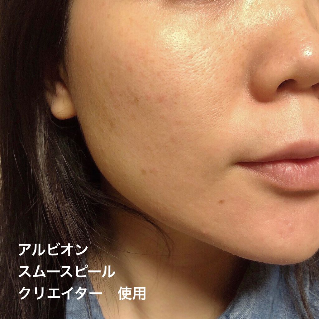 スムースピール クリエイター/ALBION/化粧下地を使ったクチコミ(3枚目)