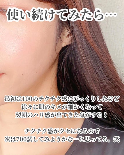 リードルショット100/VT/美容液を使ったクチコミ(5枚目)