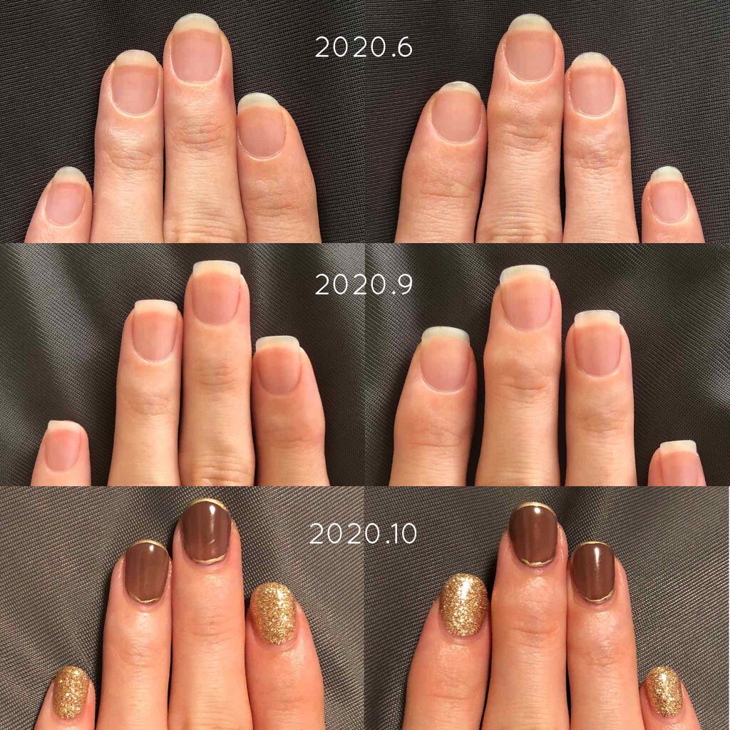 アンティセプト/LCN/ネイルオイル・トリートメントを使ったクチコミ（3枚目）