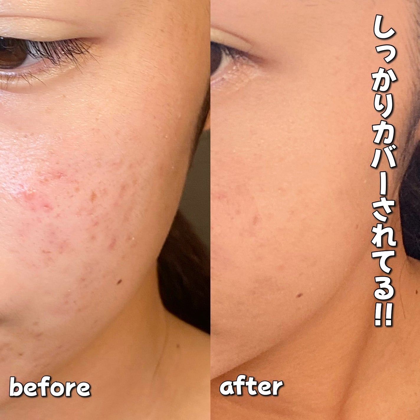 ブラーカバークッション/LUNA/クッションファンデーションを使ったクチコミ(4枚目)