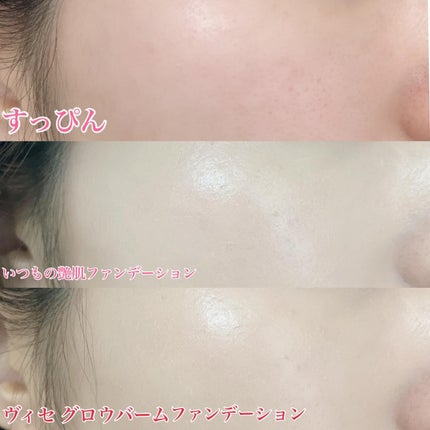 グロウバーム ファンデーション/Visée/その他ファンデーションを使ったクチコミ(2枚目)