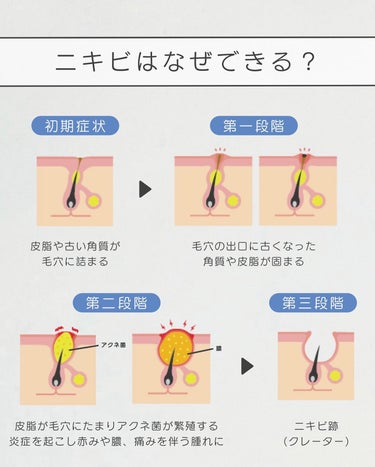 マンデリック インテンシブ 18%セラム/DR.WU/美容液を使ったクチコミ（3枚目）