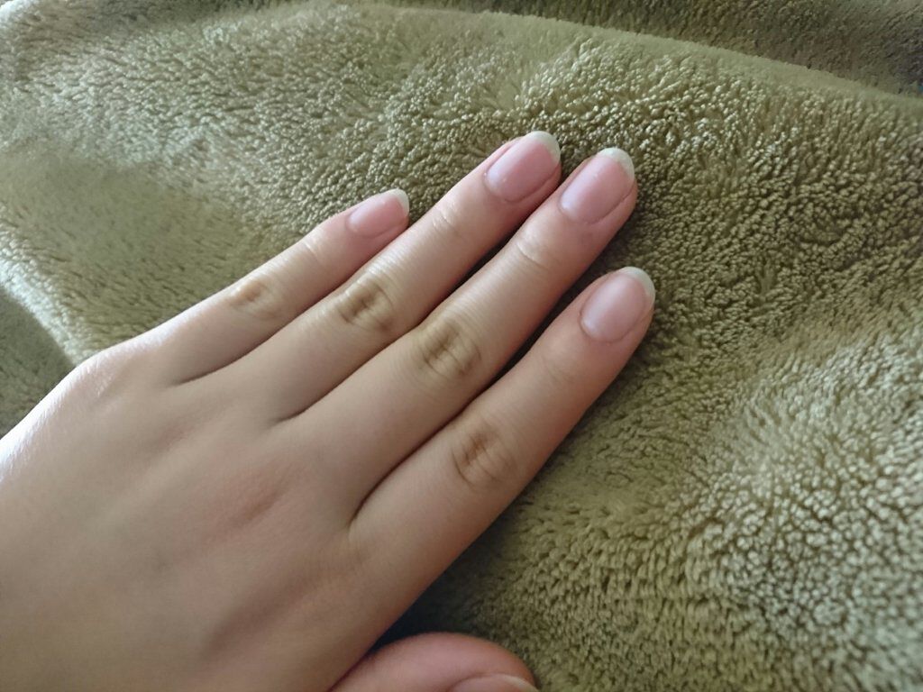 エテュセ クイックケアコート/ettusais/ネイルオイル・トリートメントを使ったクチコミ（2枚目）