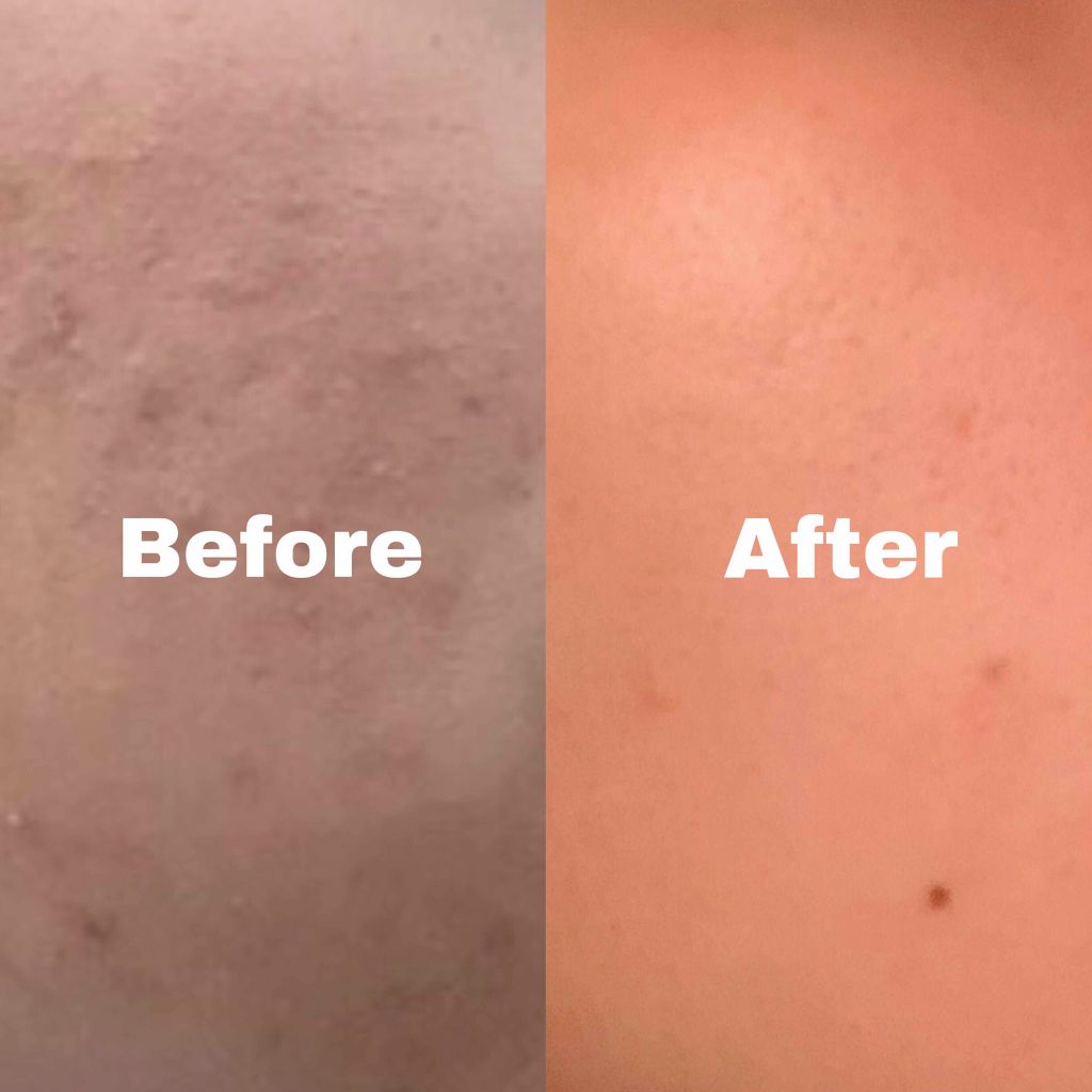 ハトムギ化粧水(ナチュリエ スキンコンディショナー R )/ナチュリエ/化粧水を使ったクチコミ（3枚目）