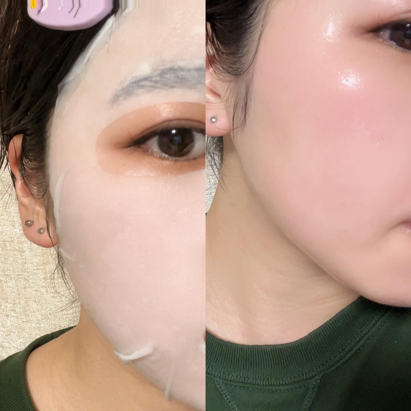 トリデン ダイブインマスクパック/Torriden/シートマスク・パックを使ったクチコミ（2枚目）