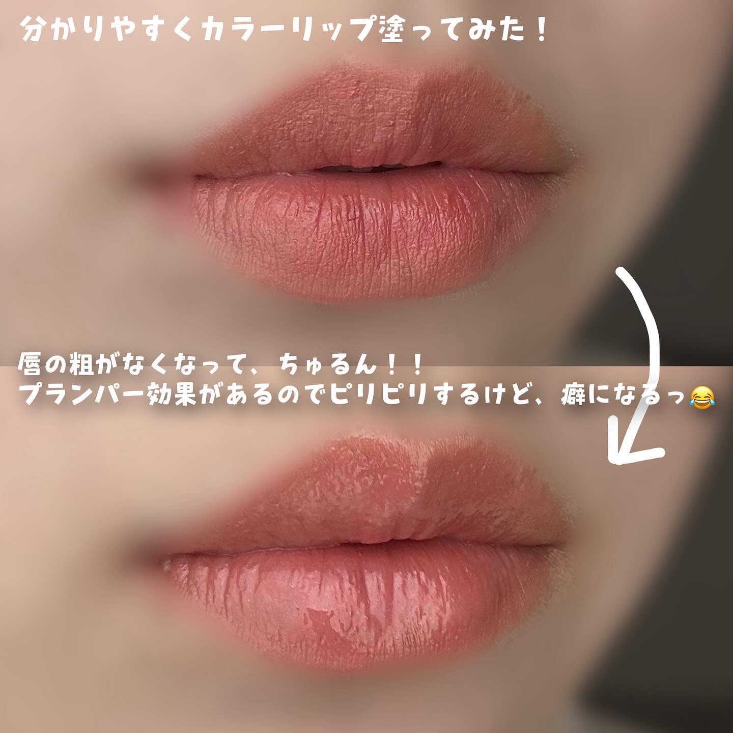 ちゅるリップランパー/muice/リッププランパーを使ったクチコミ（3枚目）