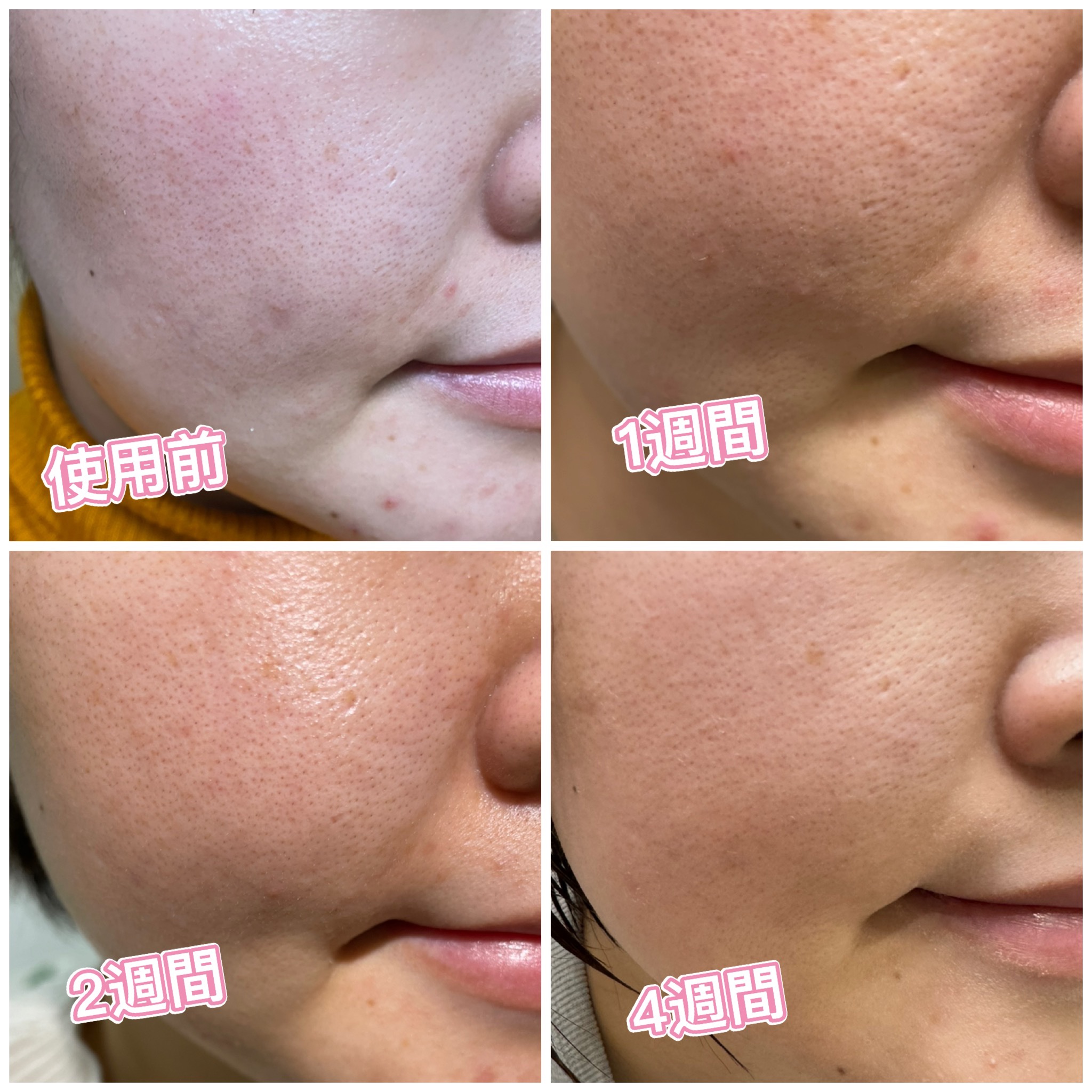 潤浸保湿 化粧水 III とてもしっとり/キュレル/化粧水を使ったクチコミ（2枚目）