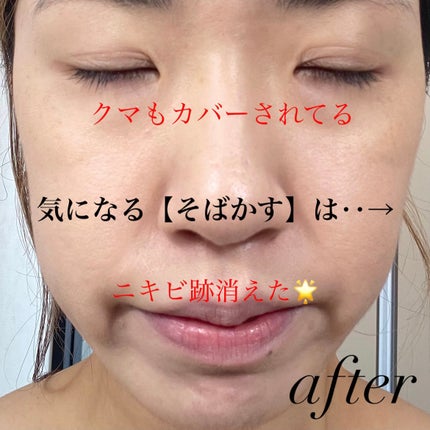 V3シャイニングファンデーション/SPICARE/クッションファンデーションを使ったクチコミ(5枚目)