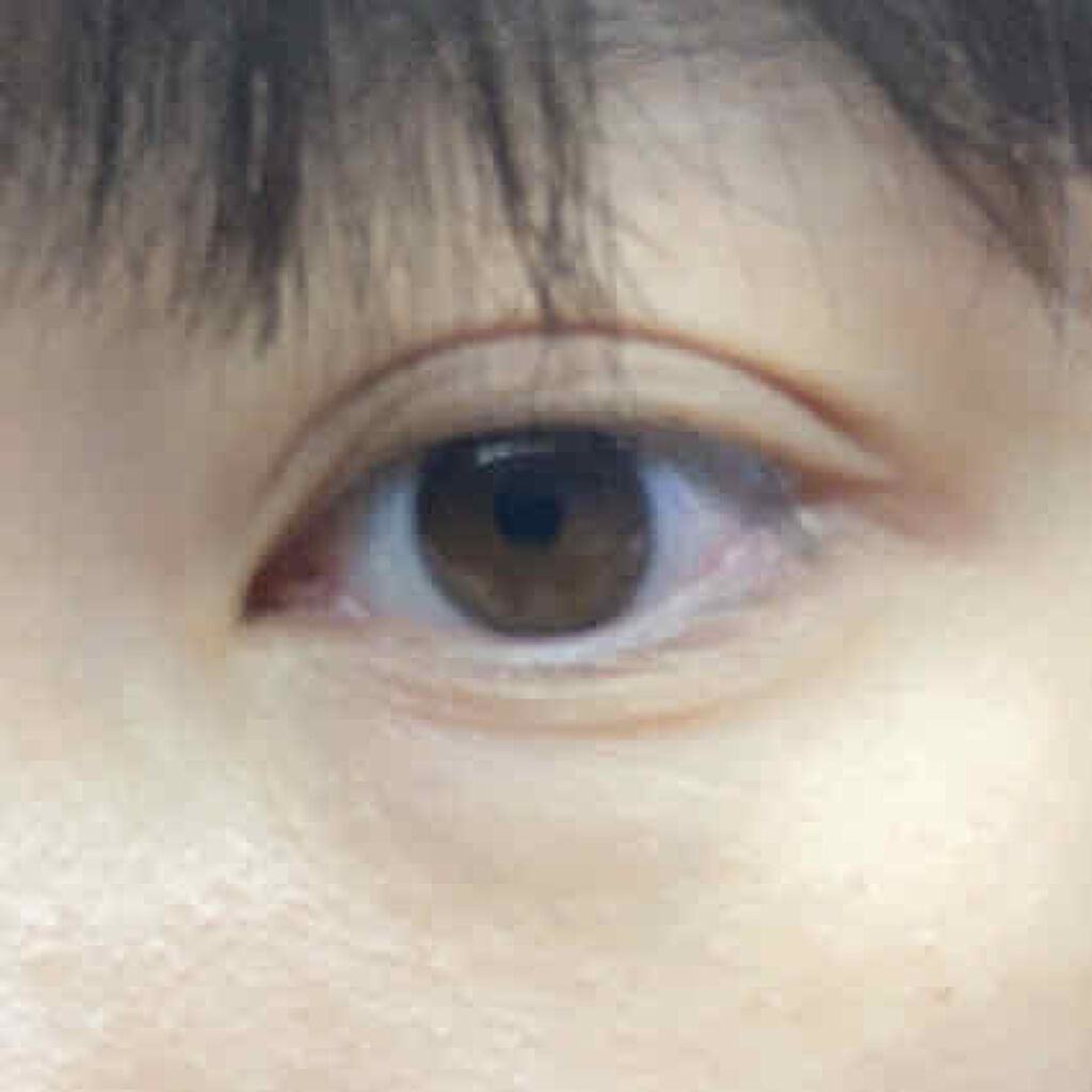 シングルアイテープ/Automatic Beauty/二重まぶた用アイテムを使ったクチコミ（3枚目）