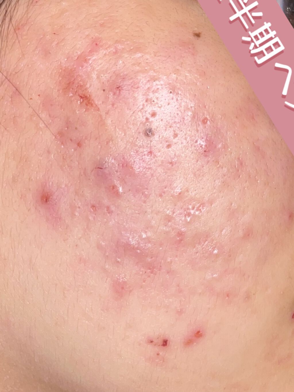 CICA カプセルマスク/VT/洗い流すパック・マスクを使ったクチコミ（2枚目）