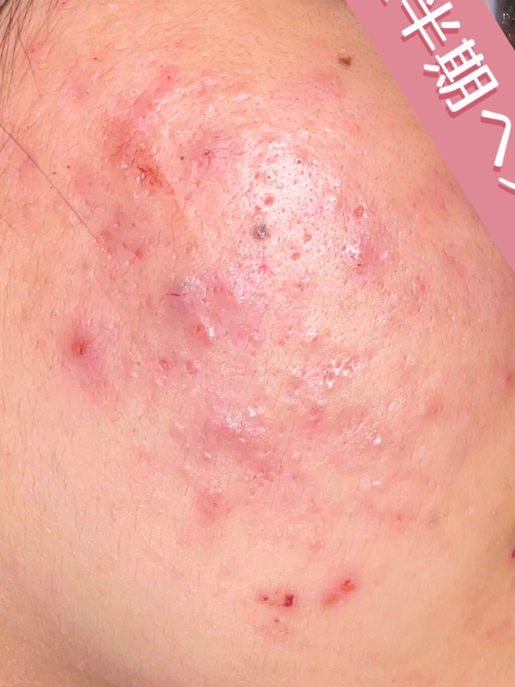 CICA カプセルマスク/VT/洗い流すパック・マスクを使ったクチコミ(2枚目)