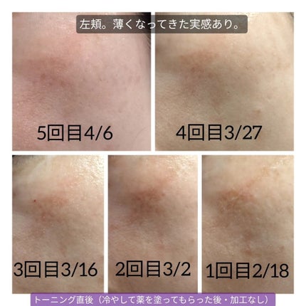 を使ったクチコミ(3枚目)