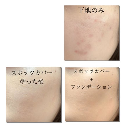 スポッツカバー ファウンデイション/SHISEIDO/クリームコンシーラーを使ったクチコミ(2枚目)