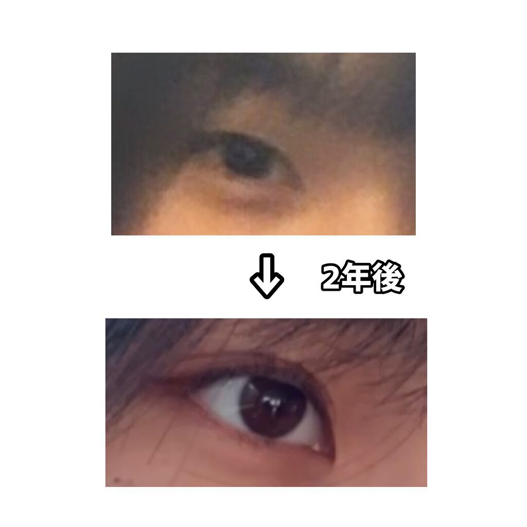 のびーるアイテープ(絆創膏タイプ、レギュラー)/DAISO/二重まぶた用アイテムを使ったクチコミ(2枚目)