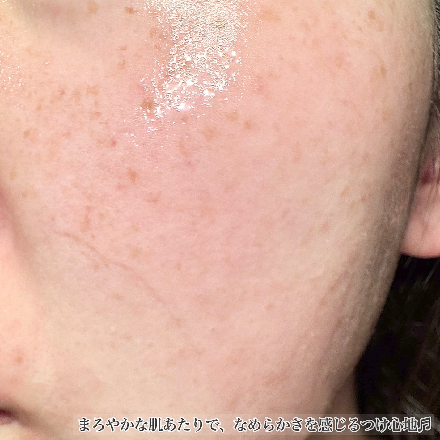 VC100エッセンスローション EX/ドクターシーラボⓇ/化粧水を使ったクチコミ(3枚目)