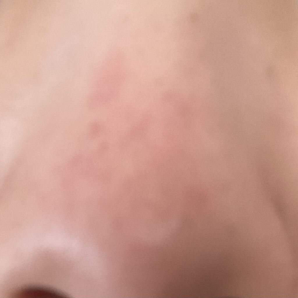 薬用しみ対策 美白化粧水/メラノCC/化粧水を使ったクチコミ（2枚目）