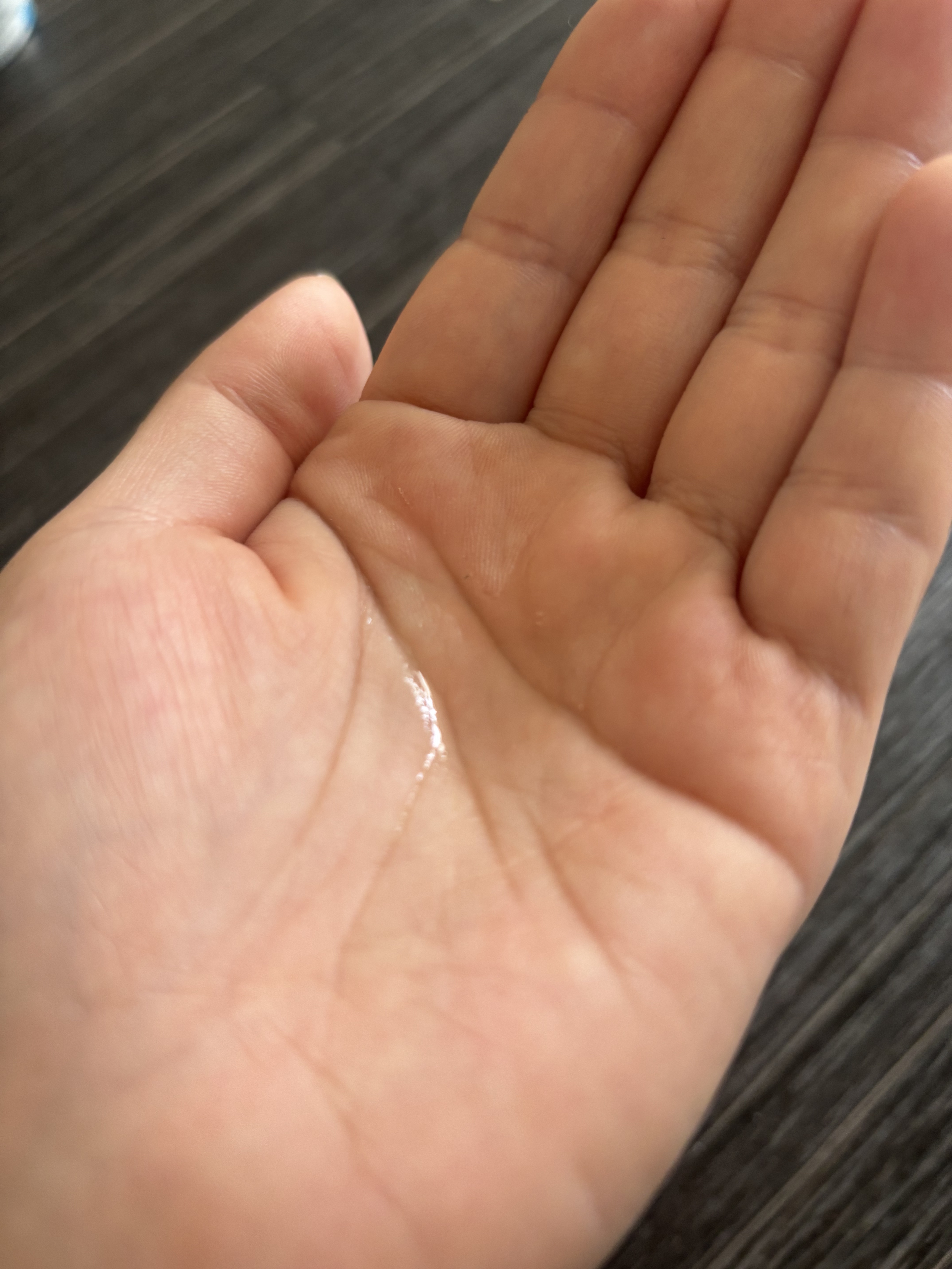 ダーマレーザー ウルセラAZ/クオリティファースト/美容液を使ったクチコミ（2枚目）