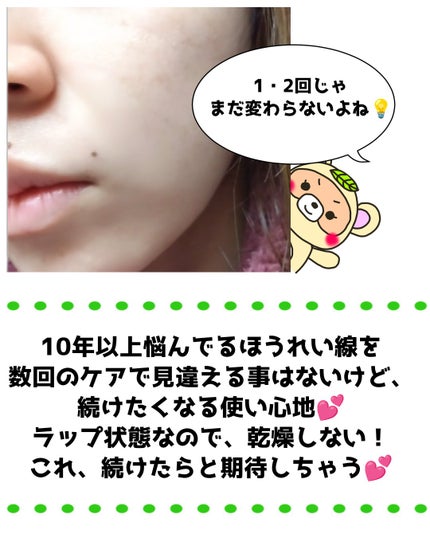 リンクルリペアしわパッチ/MARSHIQUE/その他スキンケアを使ったクチコミ(4枚目)