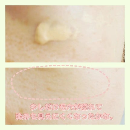 イプノス シーバムクリア リペアクリーム/ACSEINE/フェイスクリームを使ったクチコミ(2枚目)