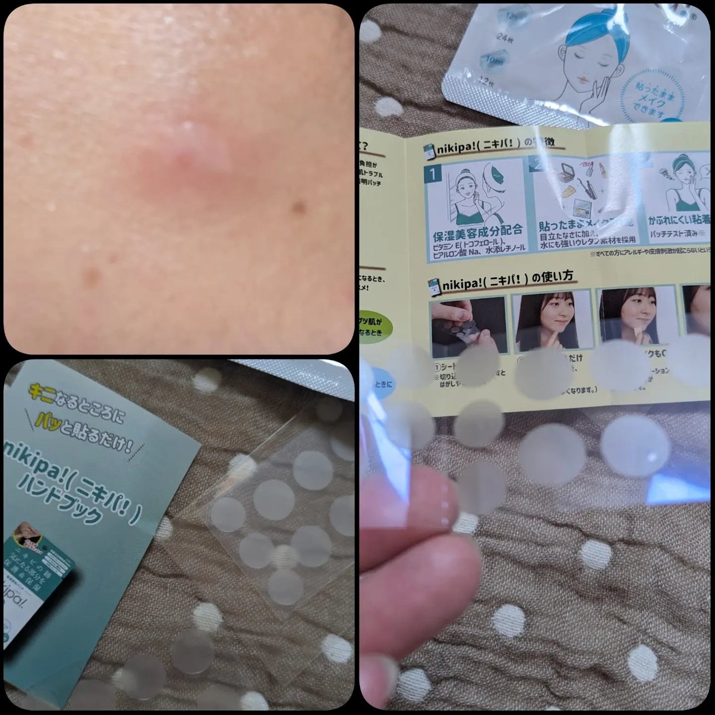 極薄透明パッチ nikipa!/金冠堂/にきびパッチを使ったクチコミ(2枚目)