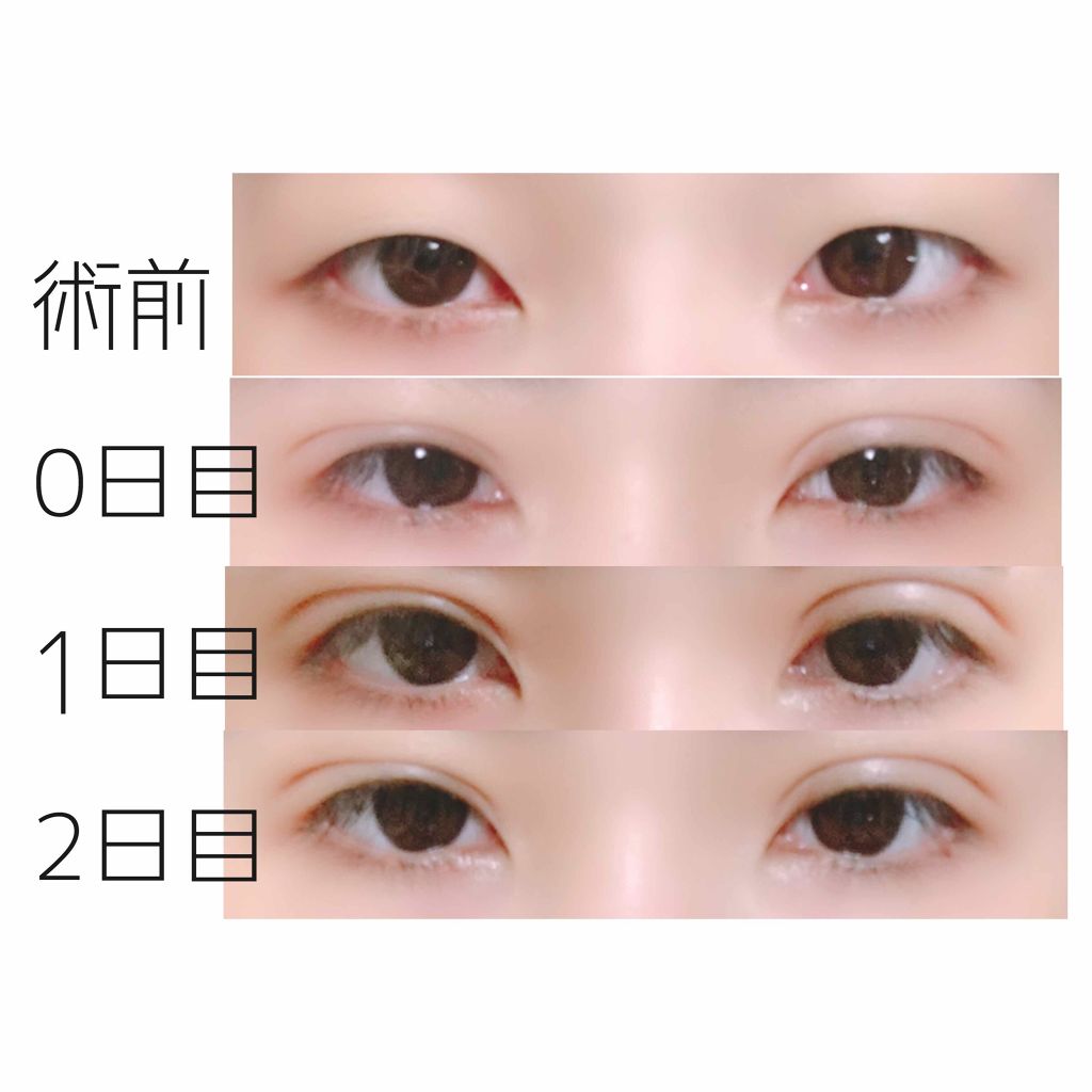 あたる on LIPS 「まいど!あたるです/^p^\流石に1枚目の画像をちゃんとそ..」(2枚目)