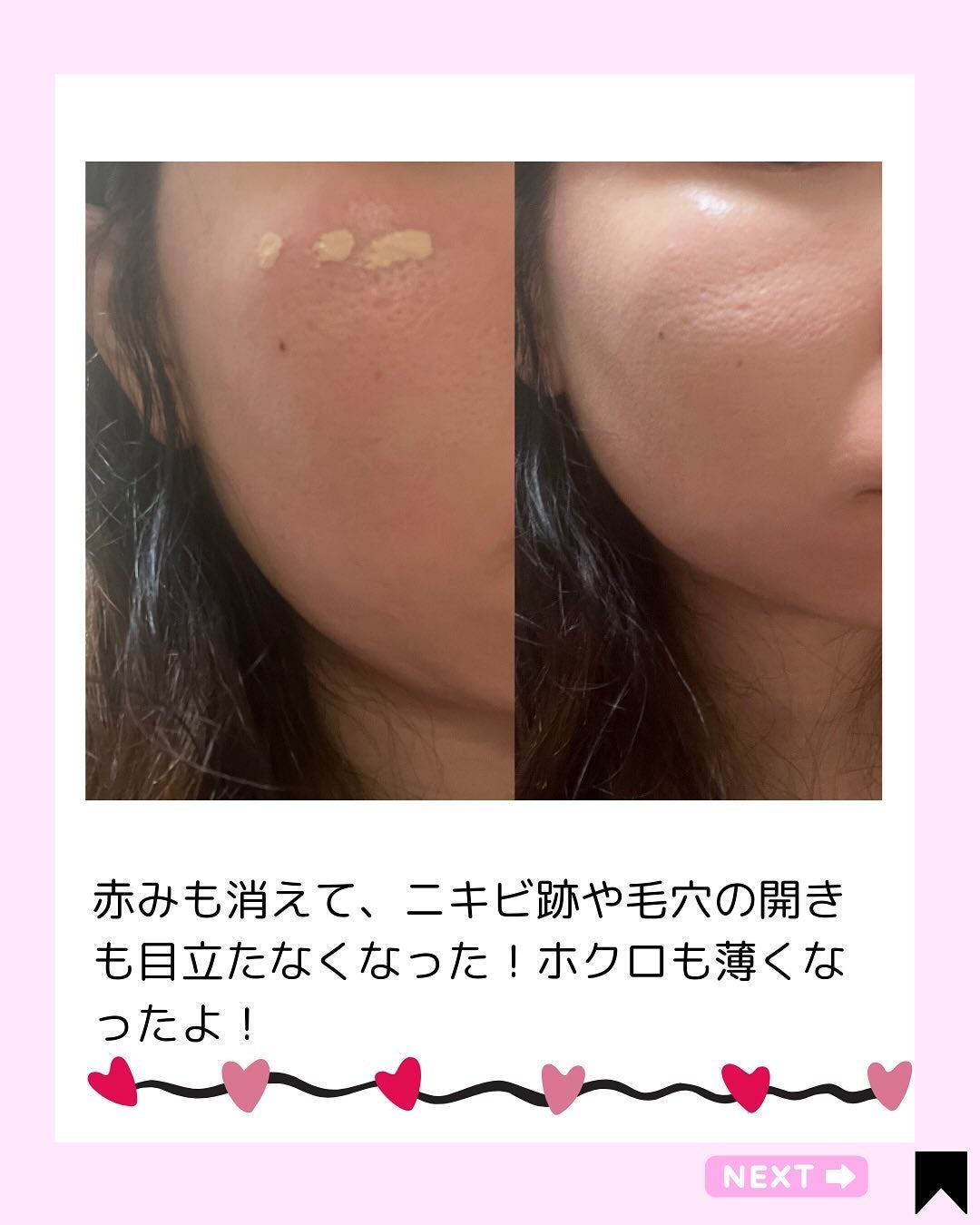 Kana on LIPS 「自然なトーンアップ🩷/@kana.cosme2525他の投稿は..」(5枚目)
