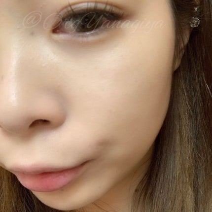 アレルバリア エッセンス BB N/d プログラム/BBクリームを使ったクチコミ(5枚目)