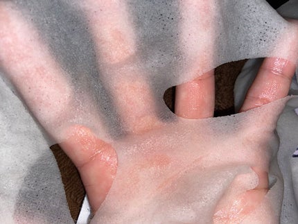 スキントラブルケア マスク/アルージェ/シートマスク・パックを使ったクチコミ(3枚目)