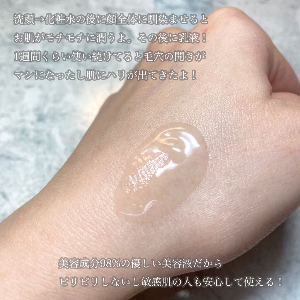 セラムショット N/PHOEBE BEAUTY UP/美容液を使ったクチコミ(3枚目)