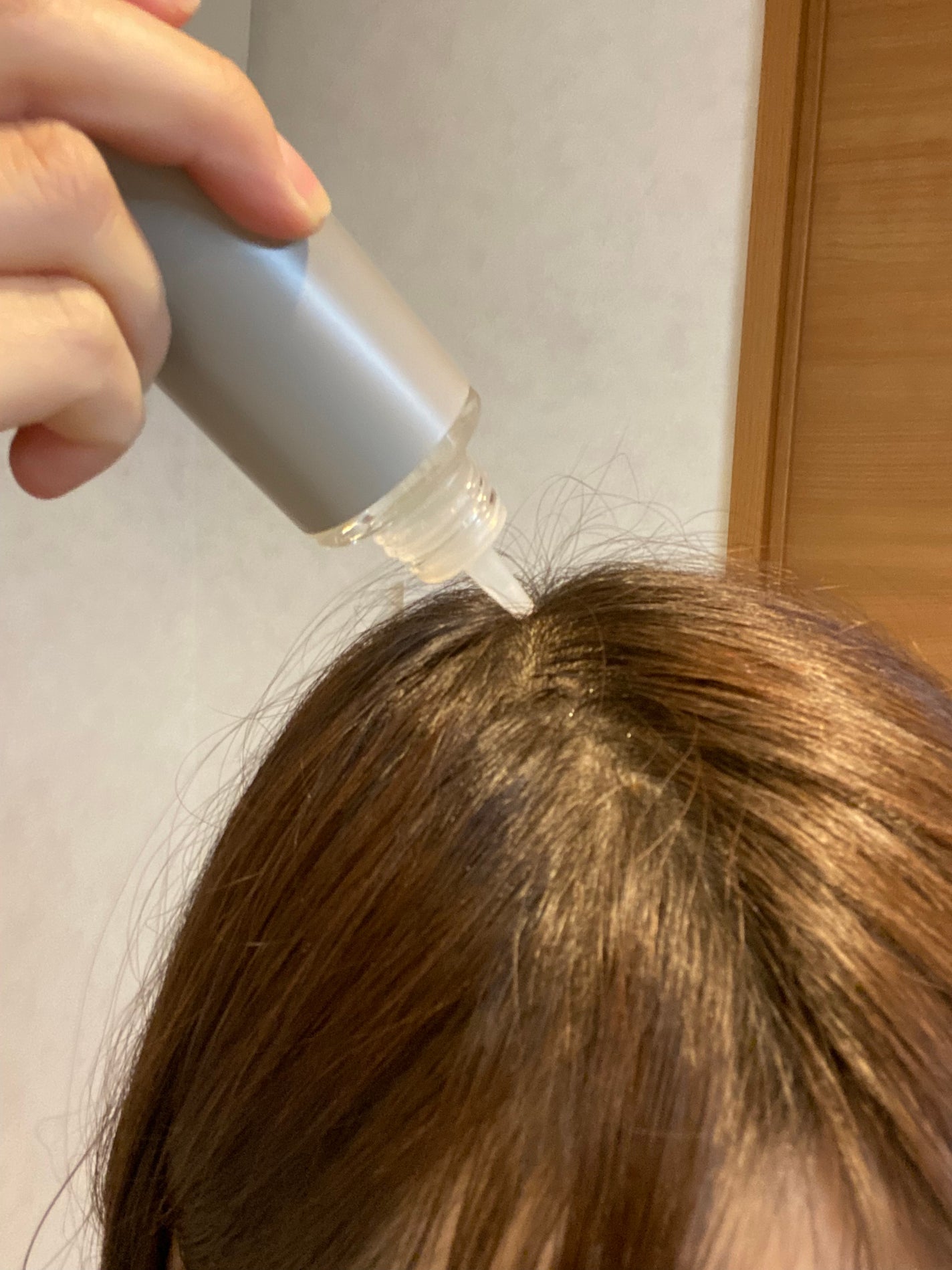 ヘアージュ 育毛剤 ヘアエッセンス/hairju/頭皮ローションを使ったクチコミ(2枚目)