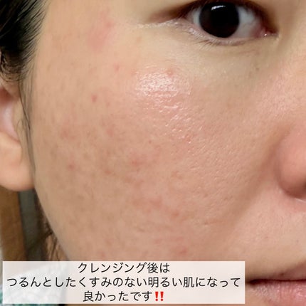 夢みるバーム 海泥スムースモイスチャー/ロゼット/クレンジングバームを使ったクチコミ(8枚目)