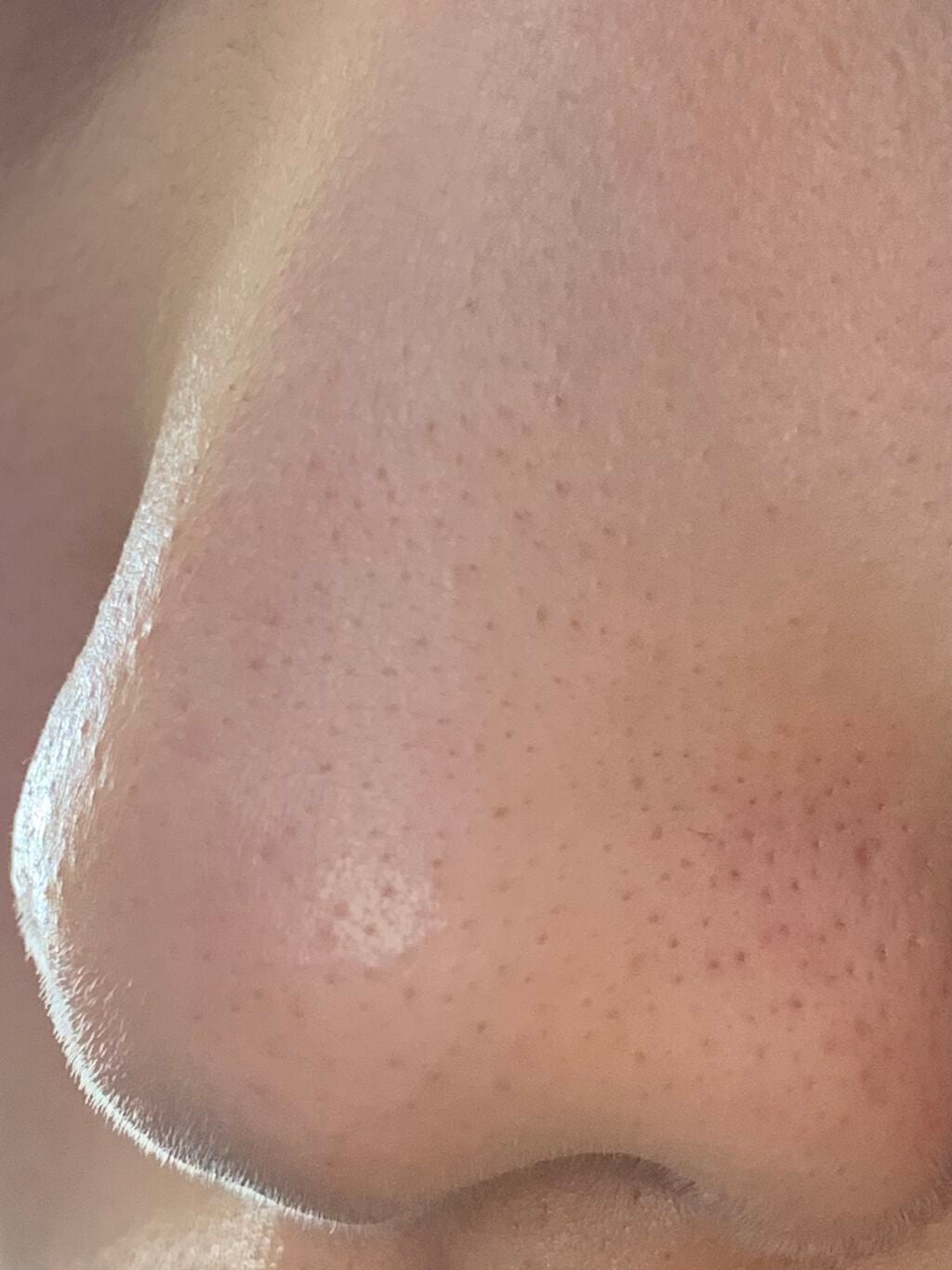 ハトムギ化粧水(ナチュリエ スキンコンディショナー R )/ナチュリエ/化粧水を使ったクチコミ(2枚目)