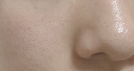 FDR アクネケア 洗顔クリーム/ファンケル/洗顔フォームを使ったクチコミ(2枚目)