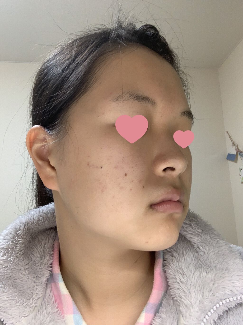 テラマイシン 軟膏(医薬品)/ジョンソン・エンド・ジョンソン/その他を使ったクチコミ（3枚目）