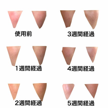 薬用 しみ 集中対策 美容液/メラノCC/美容液を使ったクチコミ(2枚目)