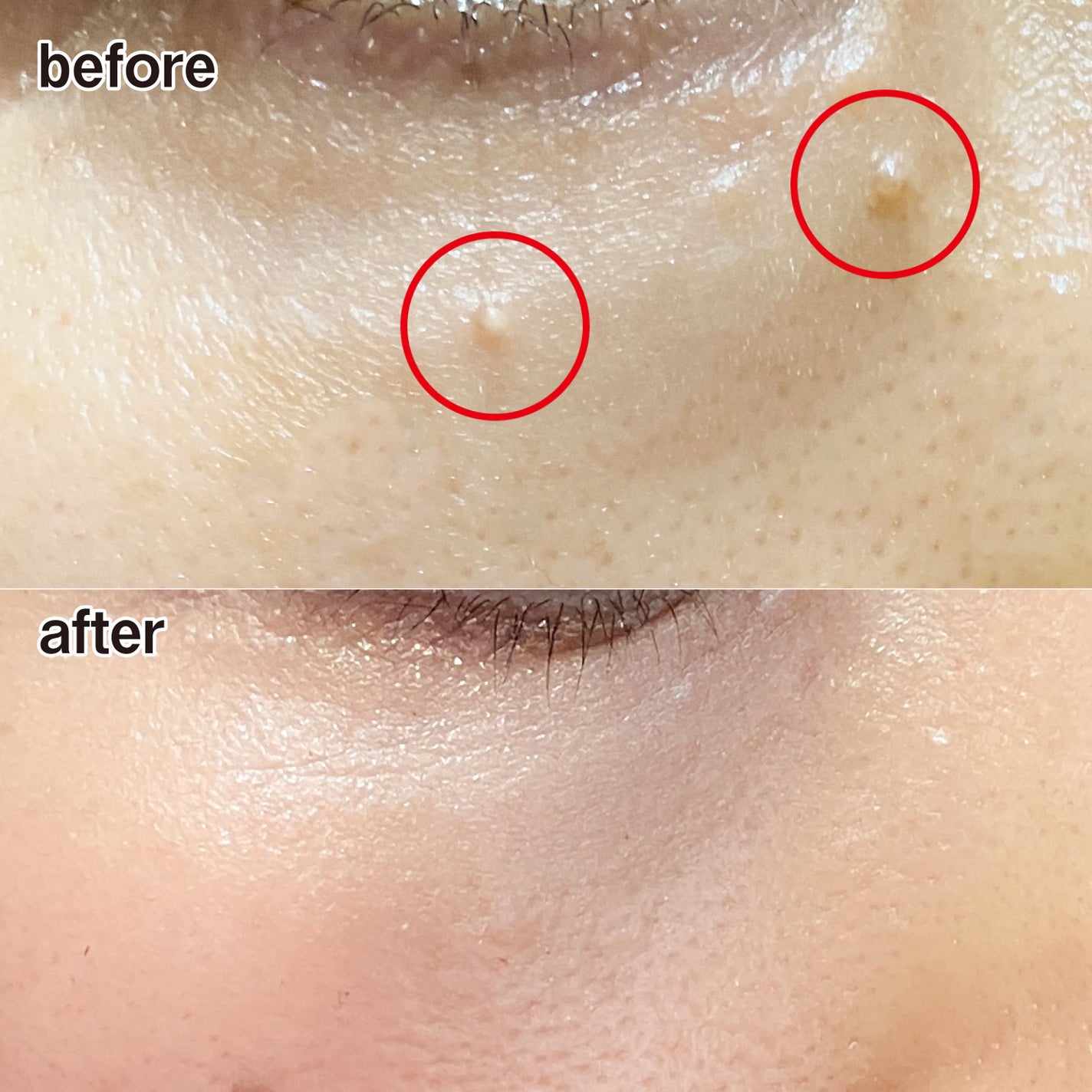 ピュアベール(医薬品)/プロペト/その他を使ったクチコミ(9枚目)