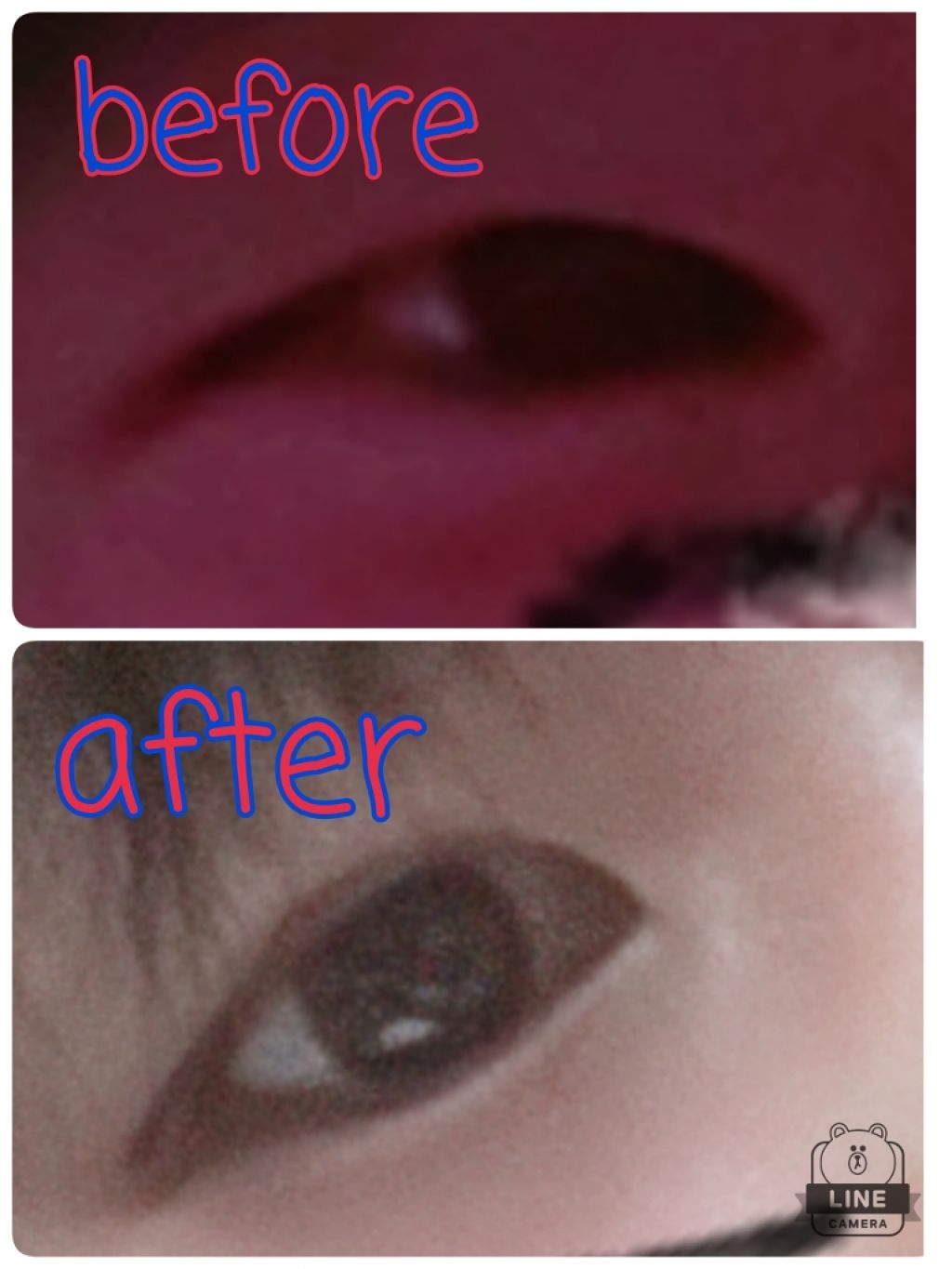 アイテープ片面(のびる)絆創膏タイプ スリム 120枚/セリア/二重まぶた用アイテムを使ったクチコミ（2枚目）