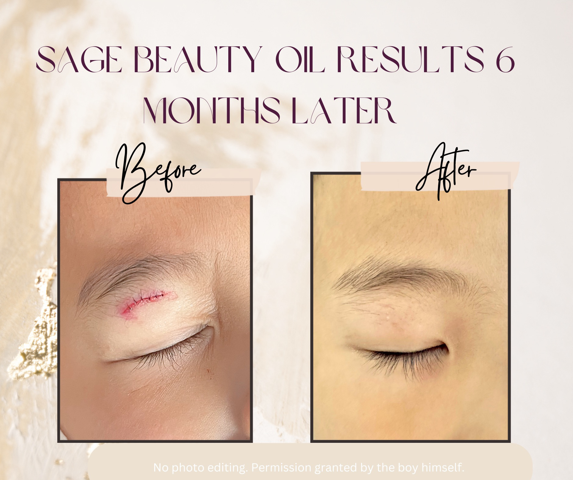 心からあこがれのモデルSHIHOさんも愛用してくださっている、SAGE ビューティーブレンドはオメガ6＆9とポリフェノールを含むファイトケミカルが豊富に含まれ、強力な抗酸化作用があります。一年中輝く健康的な肌のための、完璧な抗酸化ブースター