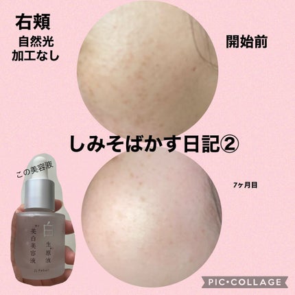 白生原液美白美容液/Rebell/美容液を使ったクチコミ(1枚目)