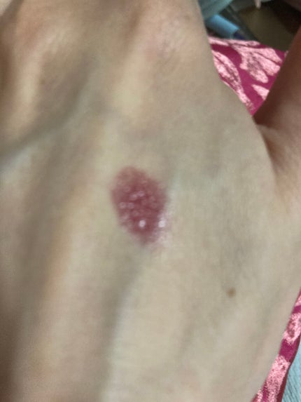 リップ&チーク ボーム N°1 ドゥ シャネル/CHANEL/口紅を使ったクチコミ(3枚目)