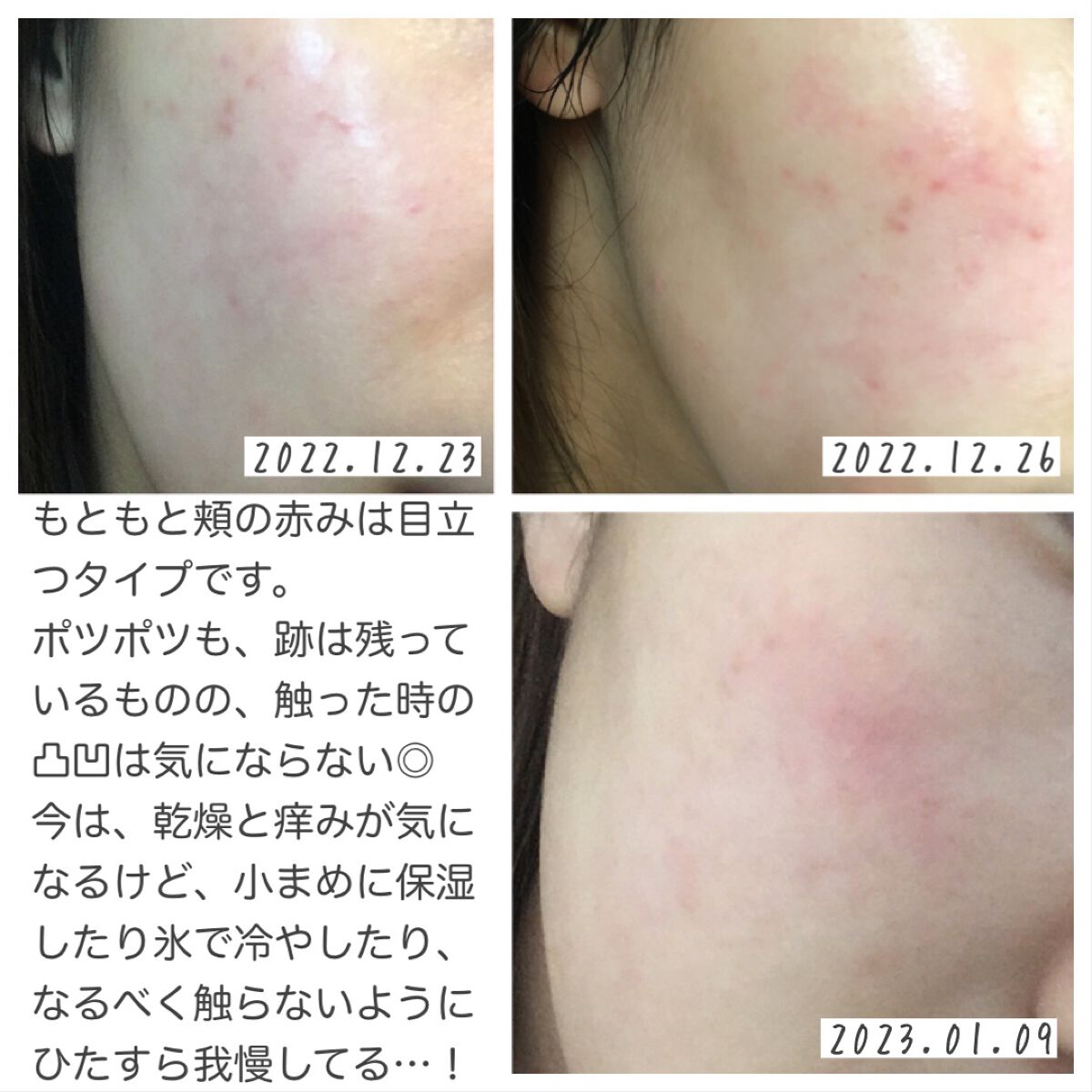 ハトムギ化粧水(ナチュリエ スキンコンディショナー R )/ナチュリエ/化粧水を使ったクチコミ(4枚目)