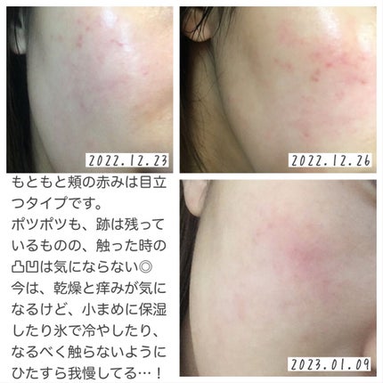 ハトムギ化粧水(ナチュリエ スキンコンディショナー R )/ナチュリエ/化粧水を使ったクチコミ(4枚目)