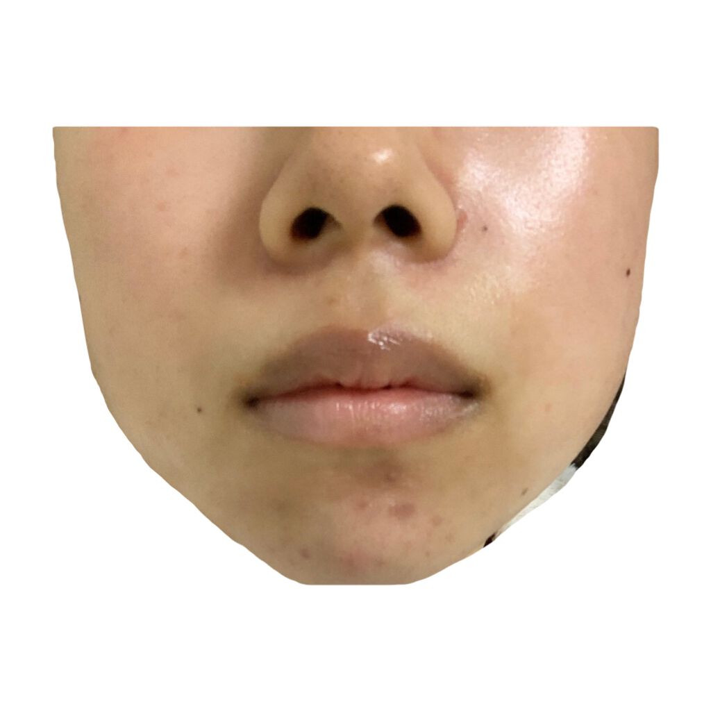 白色ワセリン(医薬品)/健栄製薬/その他を使ったクチコミ（2枚目）