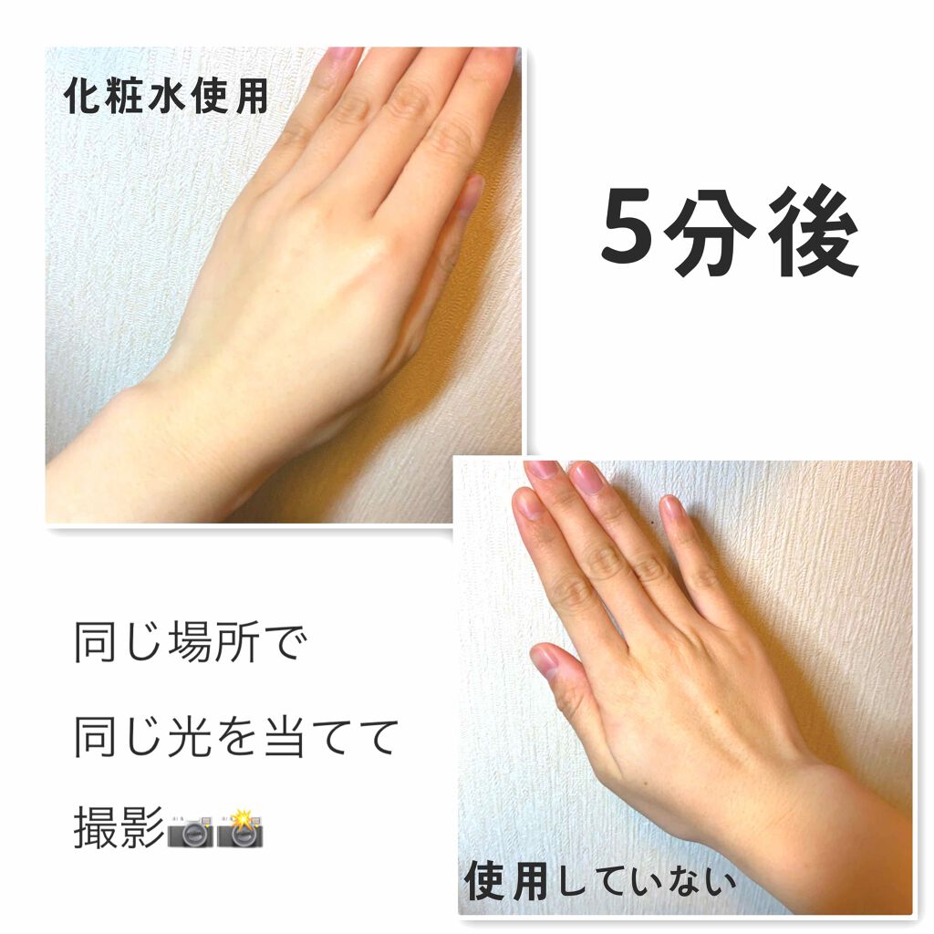 試してみた】ブランホワイトホワイトニングローションリッチモイスト ...
