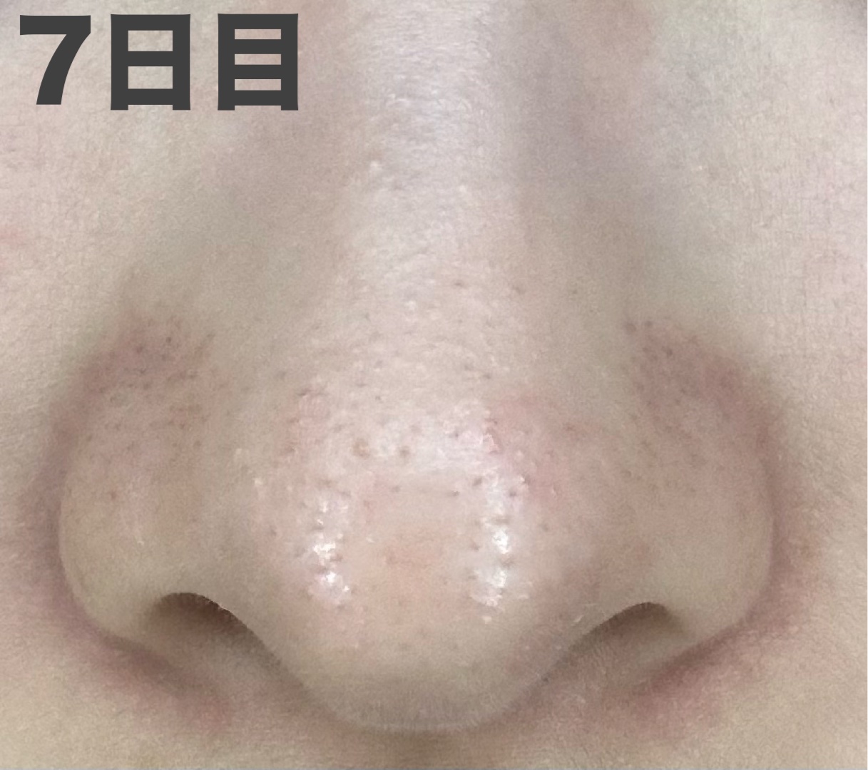 パーフェクトワンフォーカス スムースクレンジングバーム ディープブラック クロミ 限定デザイン（75g）/PERFECT ONE  FOCUS/クレンジングバームを使ったクチコミ（3枚目）