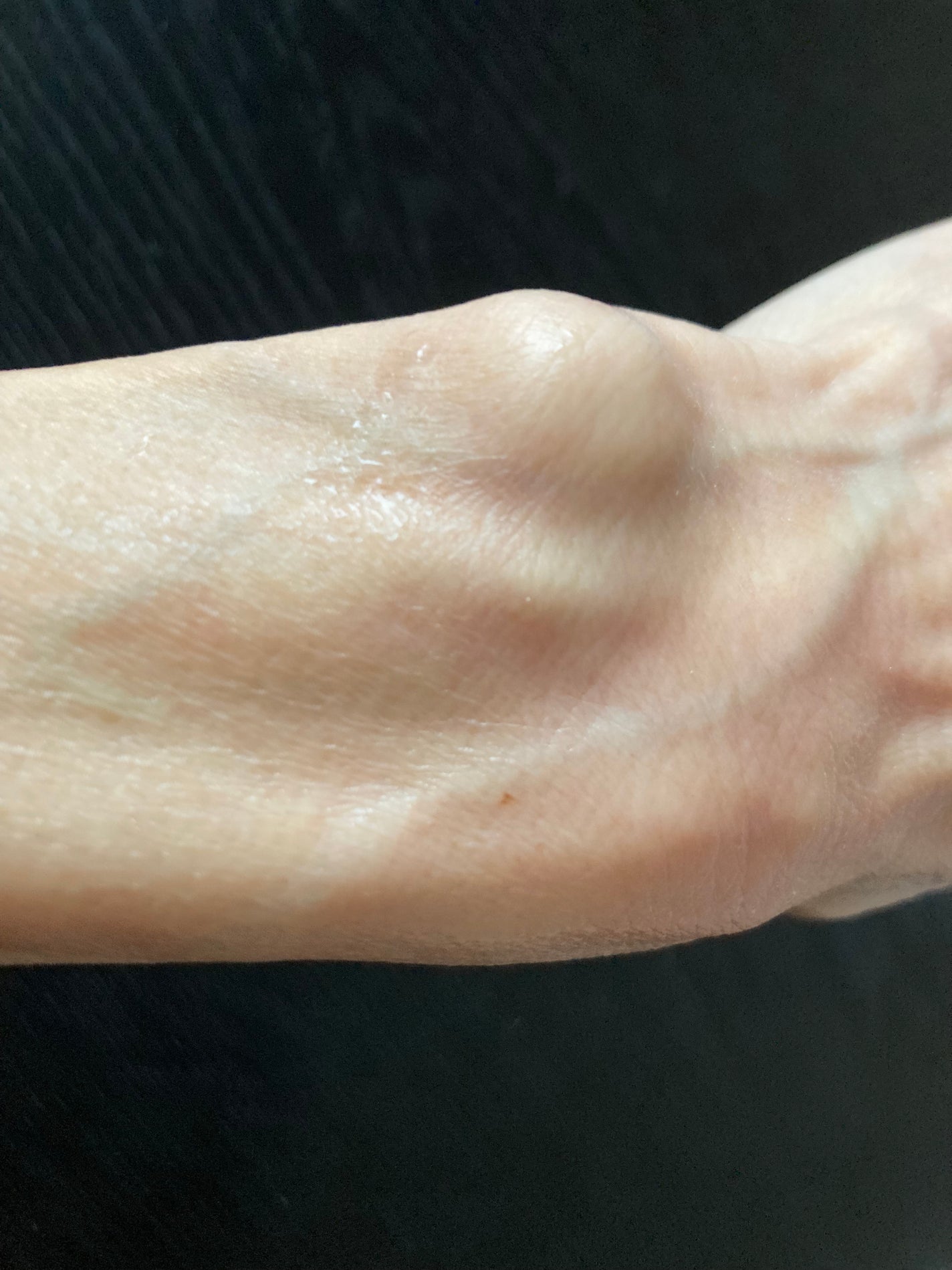 ハトムギ化粧水(ナチュリエ スキンコンディショナー R )/ナチュリエ/化粧水を使ったクチコミ(6枚目)