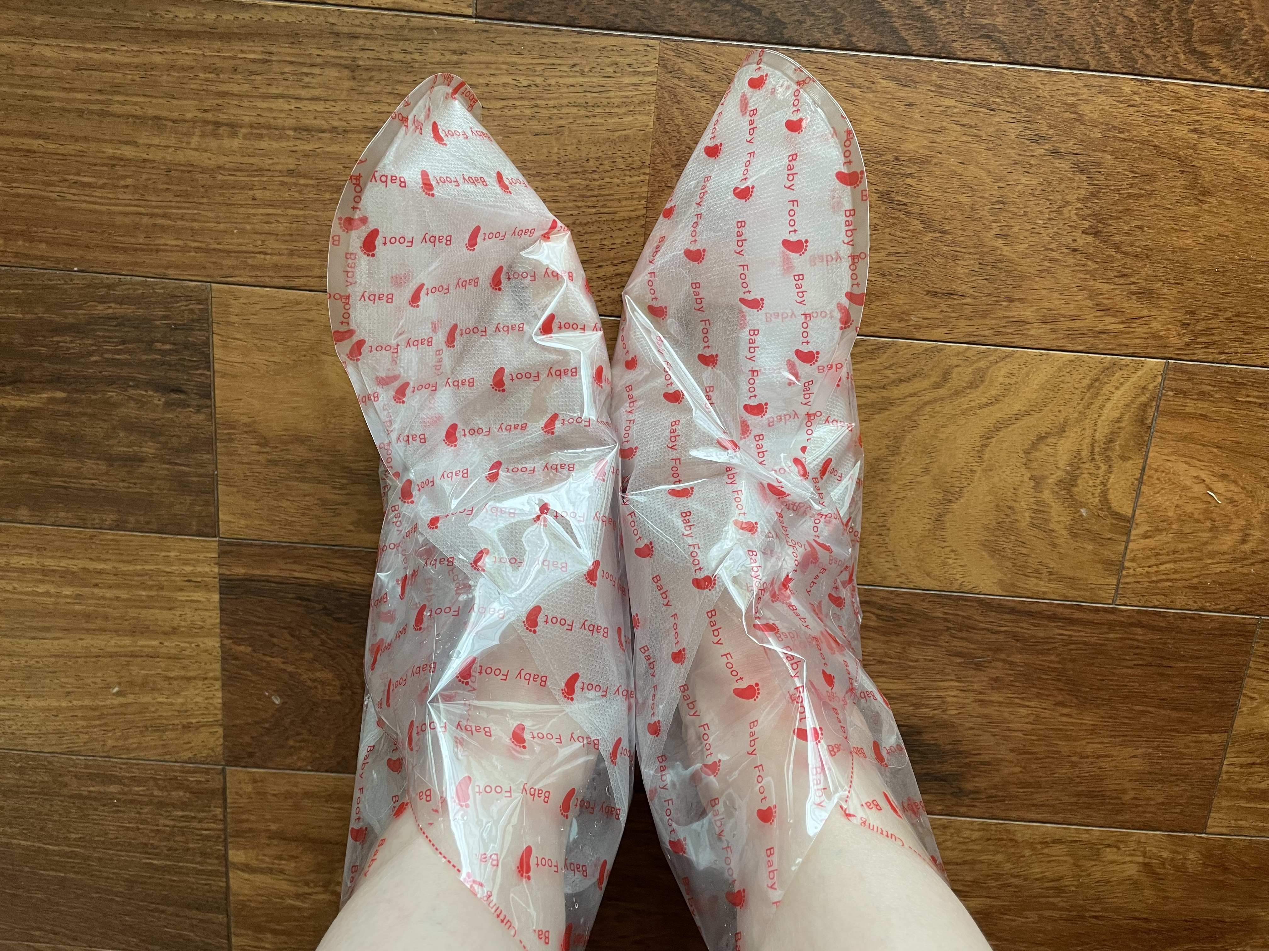 ベビーフット 重曹殺菌消毒洗浄剤/ベビーフット/レッグ・フットケアを使ったクチコミ（3枚目）